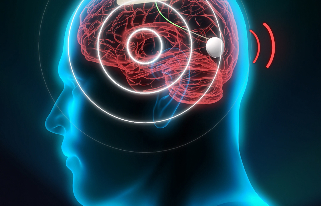 Brain sensor