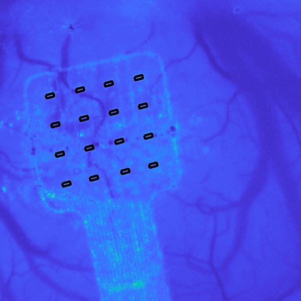 Graphene sensor brain whisper.